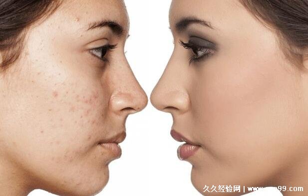 长期素颜皮肤会变好吗，会让皮肤更光滑娇嫩(皮肤保养的3种方法)